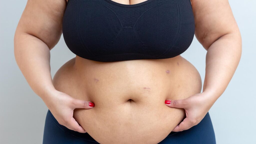 graisse abdominale